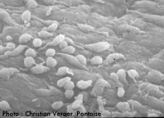 Microscopie electronique
