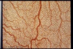 mesothratnorm